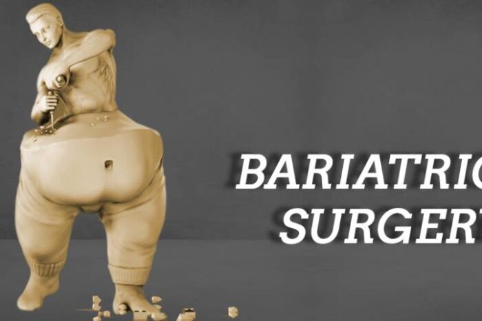 Best Bariatric surgeon in bangalore