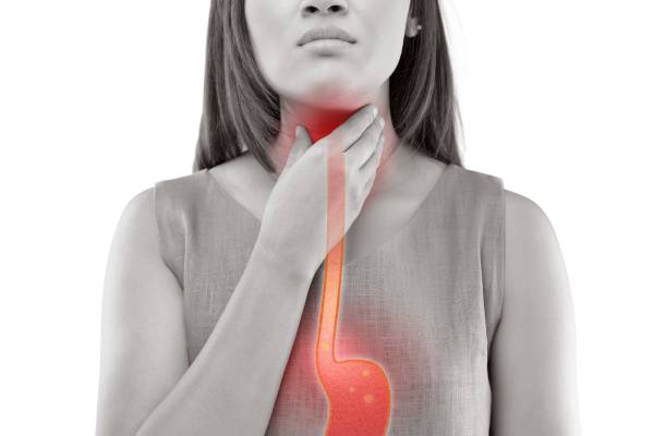 Achalasia Cardia Treatment In Bangalore